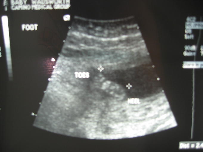 The bottom of his right foot