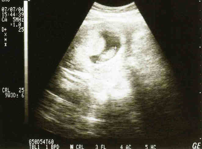 July 2004 (about 3 months old)