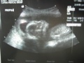 At about 4 months old