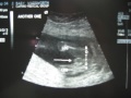 It's another boy!