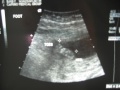 The bottom of his right foot