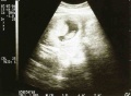 July 2004 (about 3 months old)